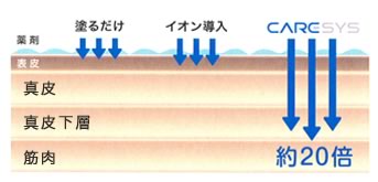 イオン導入の約20倍の量を導入できます