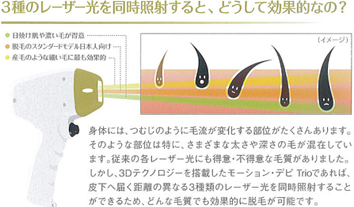 モーションデピアイス